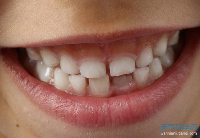 牙齿是人身上最坚硬的部分,一般人们认为梦见掉牙齿是大凶那么,这个